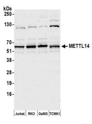 Western Blot: METTL14 Antibody [NBP2-76359] - Samples: Whole cell lysate (15 ug) from Jurkat, RKO, GaMG, and mouse TCMK-1 cells prepared using NETN lysis buffer. Antibody: Affinity purified rabbit anti-METTL14 antibody NBP2-76359 used for WB at 1:1000. Detection: Chemiluminescence with an exposure time of 10 seconds.