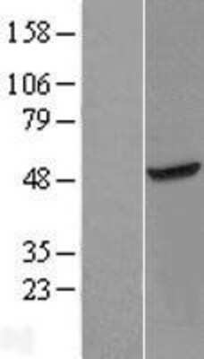 Western Blot: METTL18 Overexpression Lysate (Adult Normal) [NBL1-08300] Left-Empty vector transfected control cell lysate (HEK293 cell lysate); Right -Over-expression Lysate for METTL18.