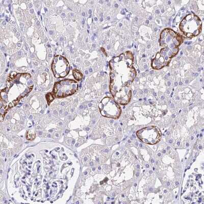 Immunohistochemistry-Paraffin: METTL19 Antibody [NBP1-92110] - Staining of human kidney shows strong cytoplasmic positivity in cells in tubules.