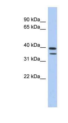 Western Blot: METTL19 Antibody [NBP1-70636] - Human Spleen lysate, concentration 0.2-1 ug/ml.
