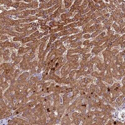 Immunohistochemistry-Paraffin: METTL20 Antibody [NBP1-87995] - Staining of human liver shows moderate cytoplasmic positivity in hepatocytes.