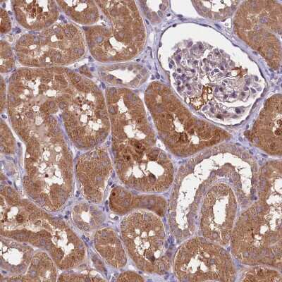 Immunohistochemistry-Paraffin: METTL20 Antibody [NBP1-87995] - Staining of human kidney shows strong cytoplasmic positivity in cells in tubules.