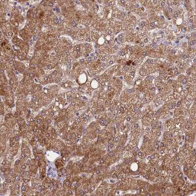 Immunohistochemistry-Paraffin METTL20 Antibody - BSA Free