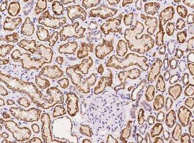 Immunohistochemistry-Paraffin: METTL20 Antibody [NBP3-05952] - Staining of human METTL20  in human kidney with rabbit polyclonal antibody at 1:100 dilution.