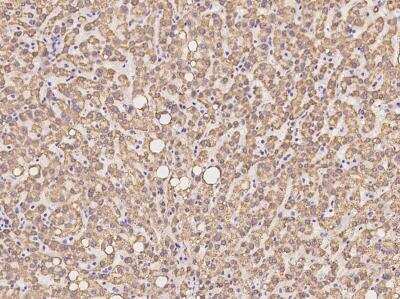 Immunohistochemistry-Paraffin: METTL20 Antibody [NBP3-05952] - Staining of human METTL20  in human liver with rabbit polyclonal antibody at 1:100 dilution.