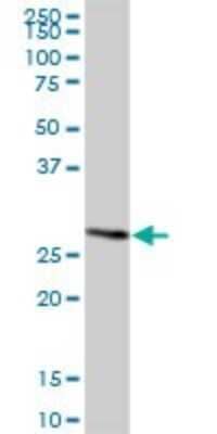 Western Blot METTL20 Antibody - Azide and BSA Free