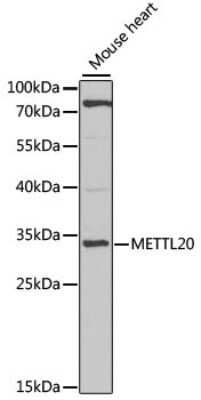 Western Blot METTL20 Antibody - BSA Free