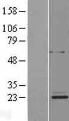 Western Blot METTL20 Overexpression Lysate