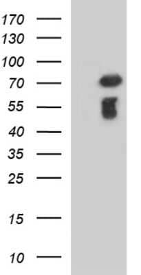 Western Blot: METTL25 Antibody (OTI2B6) - Azide and BSA Free [NBP2-72656] - Analysis of HEK293T cells were transfected with the pCMV6-ENTRY control (Left lane) or pCMV6-ENTRY METTL25.