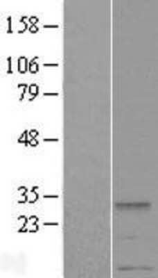 Western Blot: METTL2A Overexpression Lysate (Adult Normal) [NBL1-13023] Left-Empty vector transfected control cell lysate (HEK293 cell lysate); Right -Over-expression Lysate for METTL2A.