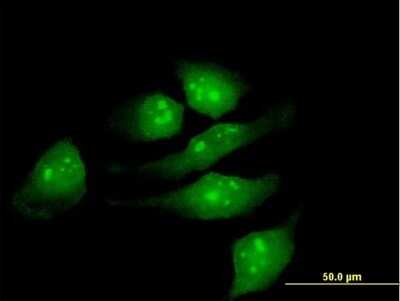 Immunocytochemistry/Immunofluorescence: METTL2B Antibody [H00055798-B01P] - Analysis of purified antibody to METTL2 on HeLa cell. (antibody concentration 10 ug/ml)