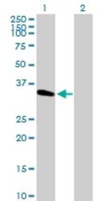 Western Blot METTL2B Antibody - Azide and BSA Free