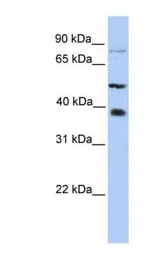 Western Blot: METTL2B Antibody [NBP1-55020] - HepG2 cell lysate, concentration 0.2-1 ug/ml.