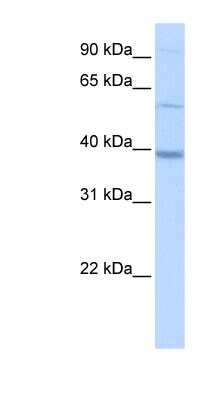 Western Blot: METTL2B Antibody [NBP1-55229] - HepG2 cell lysate, concentration 0.2-1 ug/ml.
