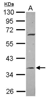 Western Blot METTL2B Antibody