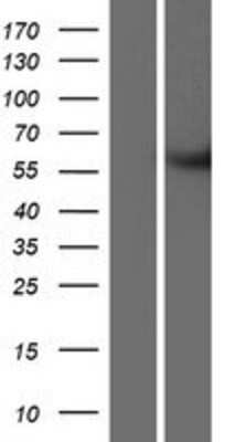 Western Blot METTL2B Overexpression Lysate