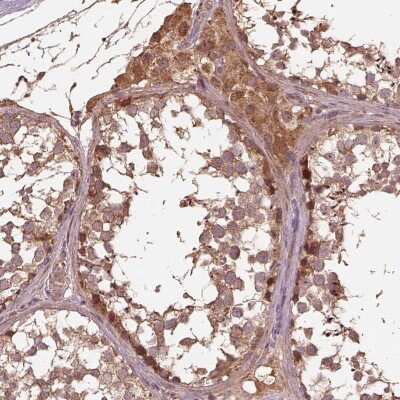 Immunohistochemistry: METTL4 Antibody [NBP2-68673] - Immunohistochemical staining of human testis shows strong cytoplasmic positivity in cells in seminiferous ducts and Leydig cells.