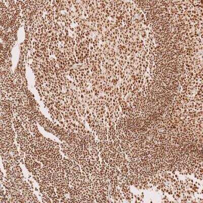 Immunohistochemistry-Paraffin: METTL4 Antibody [NBP1-82095] -  Staining of human tonsil shows strong nuclear positivity in germinal-center cells and non-germinal center cells.