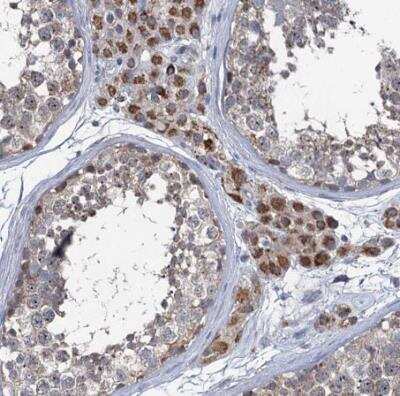 Immunohistochemistry-Paraffin: METTL4 Antibody [NBP1-82095] - Staining of human testis shows strong nuclear and cytoplasmic positivity in Leydig cells.