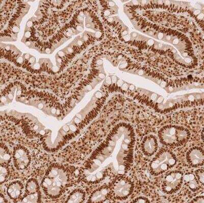 Immunohistochemistry-Paraffin: METTL4 Antibody [NBP1-82095] - Staining of human small intestine shows strong nuclear positivity in glandular cells.