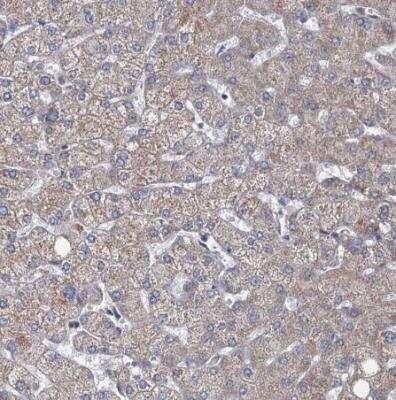 Immunohistochemistry-Paraffin METTL4 Antibody - BSA Free