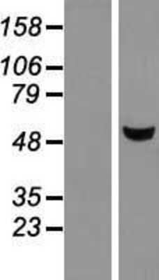 Western Blot: METTL4 Overexpression Lysate (Adult Normal) [NBL1-13024] Left-Empty vector transfected control cell lysate (HEK293 cell lysate); Right -Over-expression Lysate for METTL4.