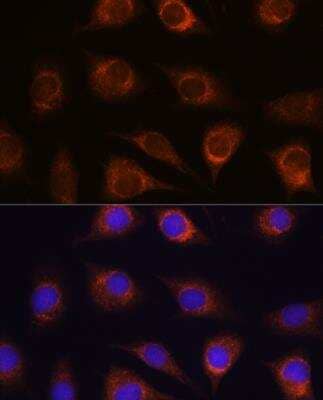Immunocytochemistry/Immunofluorescence: METTL7A Antibody [NBP3-04948] - Analysis of L929 cells using METTL7A Rabbit pAb at dilution of 1:100. Blue: DAPI for nuclear staining.