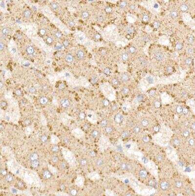 Immunohistochemistry-Paraffin: METTL7A Antibody [NBP3-04948] - Human liver using METTL7A Rabbit pAb at dilution of 1:25 (40x lens).Perform high pressure antigen retrieval with 10 mM citrate buffer pH 6.0 before commencing with IHC staining protocol.