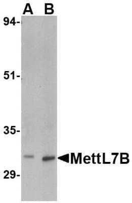 Western Blot: METTL7B Antibody [NBP1-76958] - Rat spleen tissue lysate with MettL7B antibody at (A) 2 and (B) 4 ug/mL.