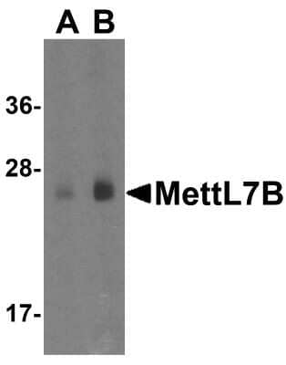 Western Blot: METTL7B Antibody [NBP1-77337] - Analysis of MettL7B in human colon tissue lysate with MettL7B antibody at (A) 1 and (B) 2 ug/mL.