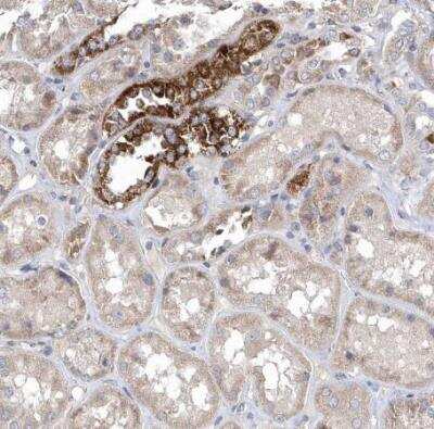 Immunohistochemistry-Paraffin METTL8 Antibody - BSA Free