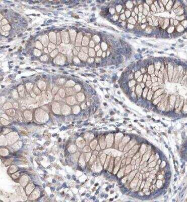 Immunohistochemistry-Paraffin METTL8 Antibody - BSA Free