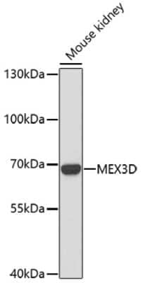 Western Blot: MEX3D Antibody [NBP3-04155] - Analysis of extracts of mouse kidney, using MEx3D antibody at 1:1000 dilution. Secondary antibody: HRP Goat Anti-Rabbit IgG (H+L) at 1:10000 dilution. Lysates/proteins: 25ug per lane. Blocking buffer: 3% nonfat dry milk in TBST. Detection: ECL Basic Kit .