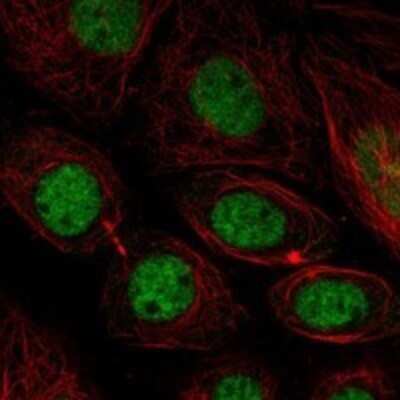 Immunocytochemistry/Immunofluorescence: MFAP1 Antibody [NBP3-17517] - Staining of human cell line SiHa shows localization to nucleoplasm.
