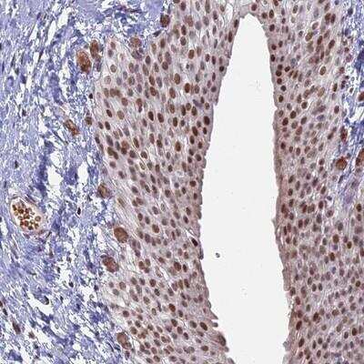 Immunohistochemistry-Paraffin: MFAP1 Antibody [NBP1-86217] - Staining of human urinary bladder shows moderate nuclear positivity in urothelial cells.