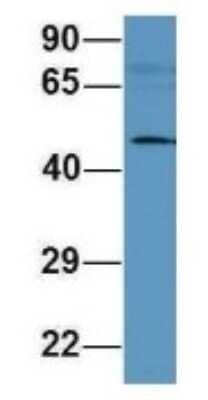 Western Blot: MFAP1 Antibody [NBP1-56849] - Analysis of 721_B cell lysate. Antibody Dilution: 1.0 ug/ml MFAP1 is supported by BioGPS gene expression data to be expressed in 721_B.