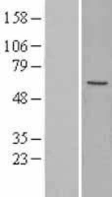 Western Blot: MFAP1 Overexpression Lysate (Adult Normal) [NBL1-13031] Left-Empty vector transfected control cell lysate (HEK293 cell lysate); Right -Over-expression Lysate for MFAP1.