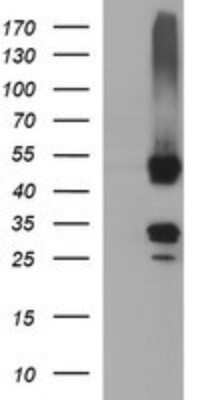 Western Blot: MFAP3 Antibody (OTI1B3) - Azide and BSA Free [NBP2-72657] - Analysis of HEK293T cells were transfected with the pCMV6-ENTRY control (Left lane) or pCMV6-ENTRY MFAP3.