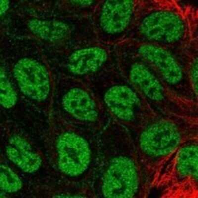 Immunocytochemistry/Immunofluorescence: MFAP3L Antibody [NBP3-17518] - Staining of human cell line RT4 shows localization to nucleoplasm & cell junctions.