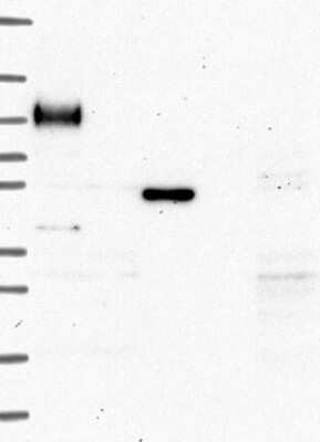 Western Blot: MFAP3L Antibody [NBP3-17518] - Lane 1: Marker [kDa] 250, 130, 95, 72, 55, 36, 28, 17, 10;   Lane 2: RT4;   Lane 3: U-251 MG;   Lane 4: Human Plasma;   Lane 5: Liver;   Lane 6: Tonsil