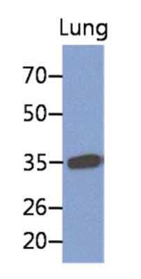 Western Blot: MFAP4 Antibody (12D11) [NBP2-42638] - Analysis of lung extract.