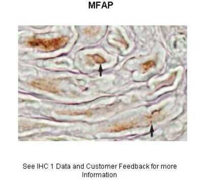 Immunohistochemistry: MFAP4 Antibody [NBP1-59158] - SampleType : Mouse sciatic nerve Dilution : 1: 500 Secondary Antibody : Biotinylated Anti-Rabbit 1: 1000 followed by avidin-biotin and diaminobenzidine Secondary Antibody Dilution : 1: 1000 Gene Name : MFAP4