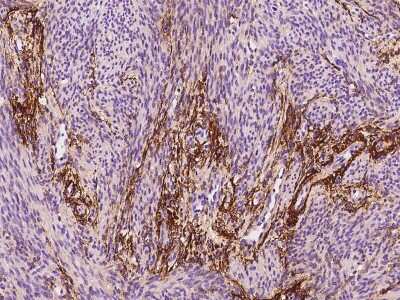 Immunohistochemistry-Paraffin: MFAP4 Antibody [NBP2-97485] - Immunochemical staining of human MFAP4 in human corpus uteri with rabbit polyclonal antibody at 1:200 dilution, formalin-fixed paraffin embedded sections.