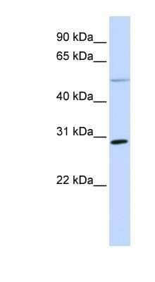 Western Blot: MFAP4 Antibody [NBP1-59158] - Titration: 0.2-1 ug/ml, Positive Control: MCF7 cell lysate.