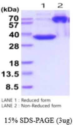 SDS-Page: MFAP4 Recombinant Protein [NBP2-53073] - 15% SDS-PAGE (3ug), Lane 1: Reduced form, Lane 2: Non-reduced form.