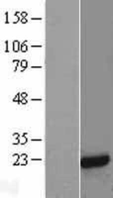 Western Blot: MFAP5 Overexpression Lysate (Adult Normal) [NBL1-13036] Left-Empty vector transfected control cell lysate (HEK293 cell lysate); Right -Over-expression Lysate for MFAP5.