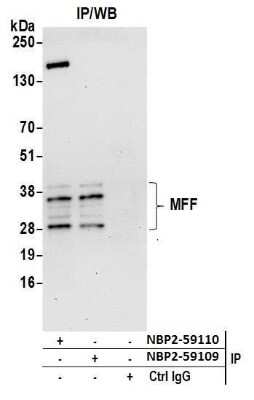Western Blot: MFF Antibody [NBP2-59110] - Detection of human MFF by western blot of immunoprecipitates. Samples: Whole cell lysate (0.5 or 1.0 mg per IP reaction; 20% of IP loaded) from 293T (50ug) cells prepared using NETN lysis buffer. Antibodies: Affinity purified rabbit anti-MFF antibody NBP2-59110 used for IP at 20 ul per reaction. MFF was also immunoprecipitated by rabbit anti-MFF antibody NBP2-59109. For blotting immunoprecipitated MFF,NBP2-59110 was used at 1:250. Detection: Chemiluminescence with an exposure time of 30 seconds.