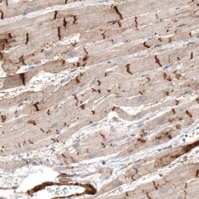 Immunohistochemistry-Paraffin: MFG-E8 Antibody [NBP1-90023] - Staining of human heart muscle shows moderate to strong cytoplasmic positivity in intercalated discs.