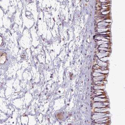 Immunohistochemistry: C1qTNF5/CTRP5 Antibody [NBP2-34052] -  Staining of human nasopharynx shows moderate cytoplasmic positivity in respiratory epithelial cells.