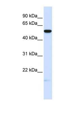 Western Blot: MFRP Antibody [NBP1-59568] - Human Placenta lysate, concentration 0.2-1 ug/ml.